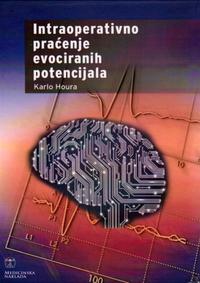 intraoperativno pracenje evociranih potencijala c21a8a